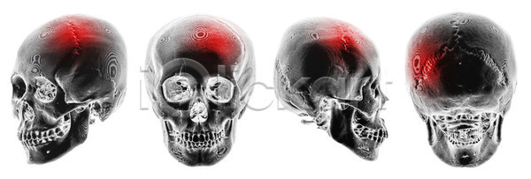 불안 사람 사람없음 3D JPG 포토 해외이미지 X 건강 검은색 고립 고양이 골격 골절 광선 깨짐 뇌 두통 머리 백그라운드 병원 빨간색 뼈 사건 세트 수집 스캐너 시스템 얼굴 엑스레이 컴퓨터 타격 필름 해골모형 해부 해외202004 해외포토 환자 흰색