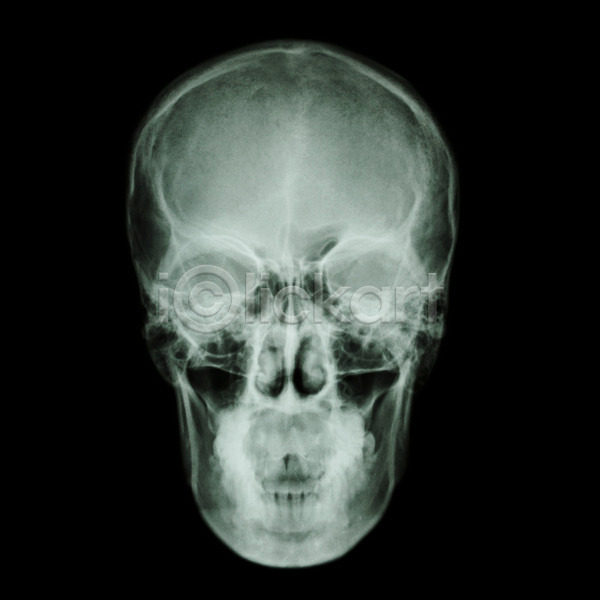 고통 동양인 사람 사람없음 JPG 포토 해외이미지 X 건강 고립 골격 광선 뇌 돌봄 두통 머리 방사선 병원 뼈 사건 시스템 신체 약 얼굴 엑스레이 외과 의사 정형외과 죽음 질병 타격 턱 해골모형 해부 해외202004 환자